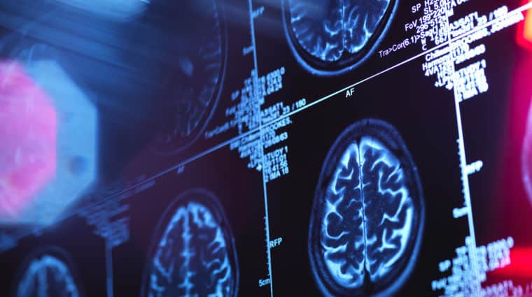 Human Brain Scan In A Neurology Clinic